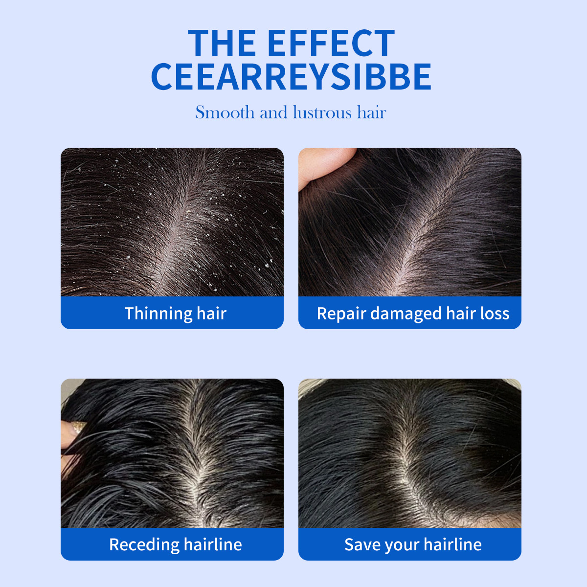 325ml Selenyum Disülfür Kepek  - Hair Care Dandruff incelemesi ve fiyatı