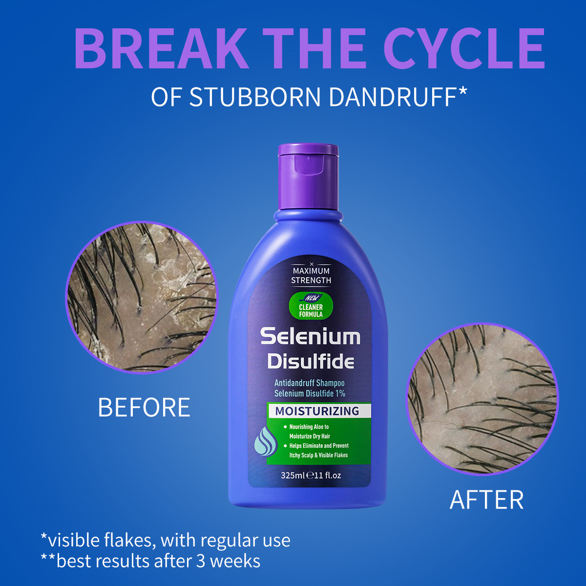 325ml Selenyum Disülfür Kepek  - Hair Care Dandruff incelemesi ve fiyatı