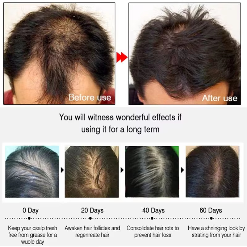 Hızlı Zencefilli Saç Uzatma Sp - Hair Care Products incelemesi ve fiyatı